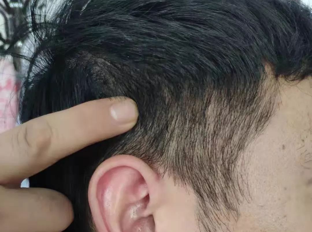 怎样帮中风的人做康复训练视频,如何解决中风后遗症问题