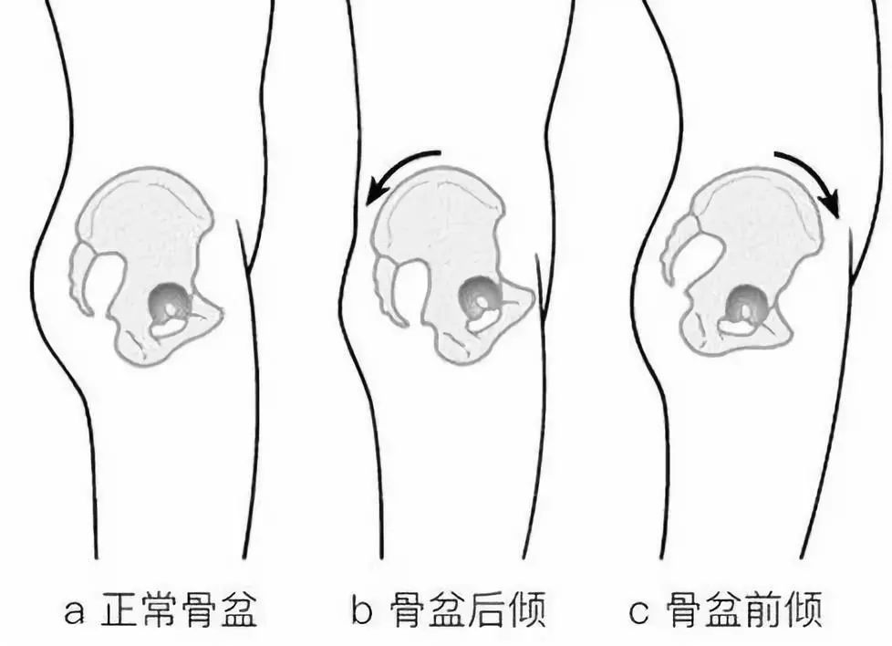 梨形身材臀腿粗怎么减,扁平臀假胯宽怎么改善