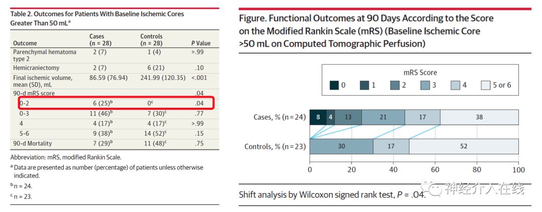 文献新萃·第六期|血管内治疗对大梗死核心患者是杯水车薪还是救命稻草？