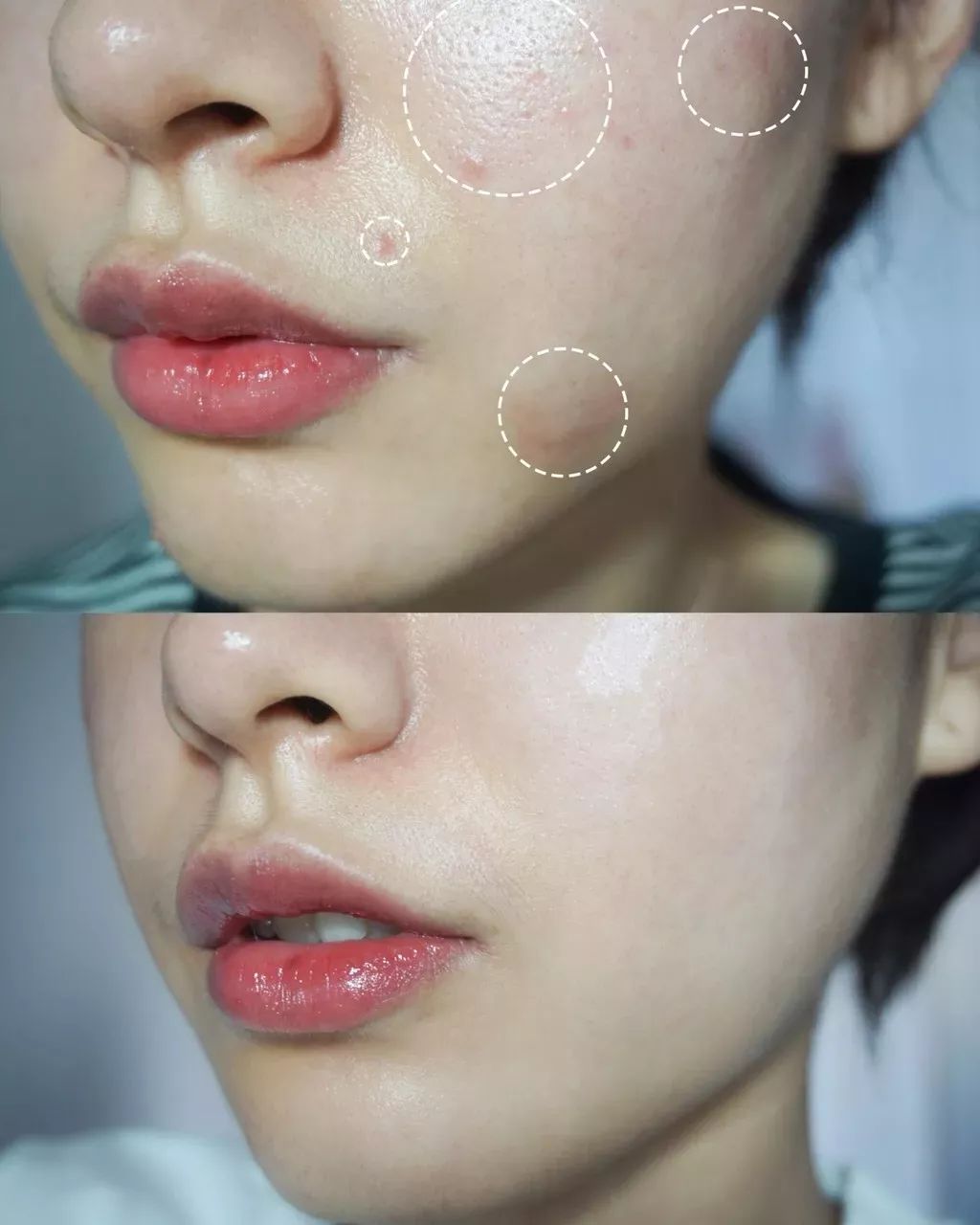 护肤小红书都在推荐的安瓶面膜,护肤补水推荐小红书