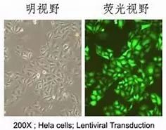 她拥有永生,靠此造福10亿人,死于癌症后,她的细胞带她重生!