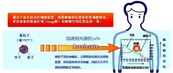 四川华西医院治疗癌症试验成功,四川华西医院治疗癌症怎么样