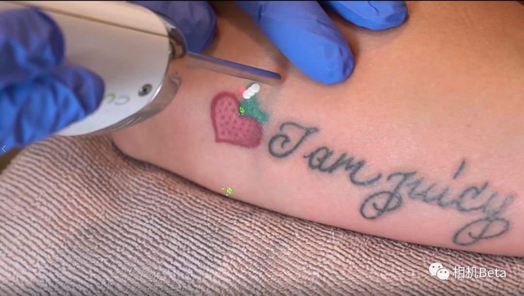 激光洗纹身真的不会留疤吗,索尼a7s2斑马纹