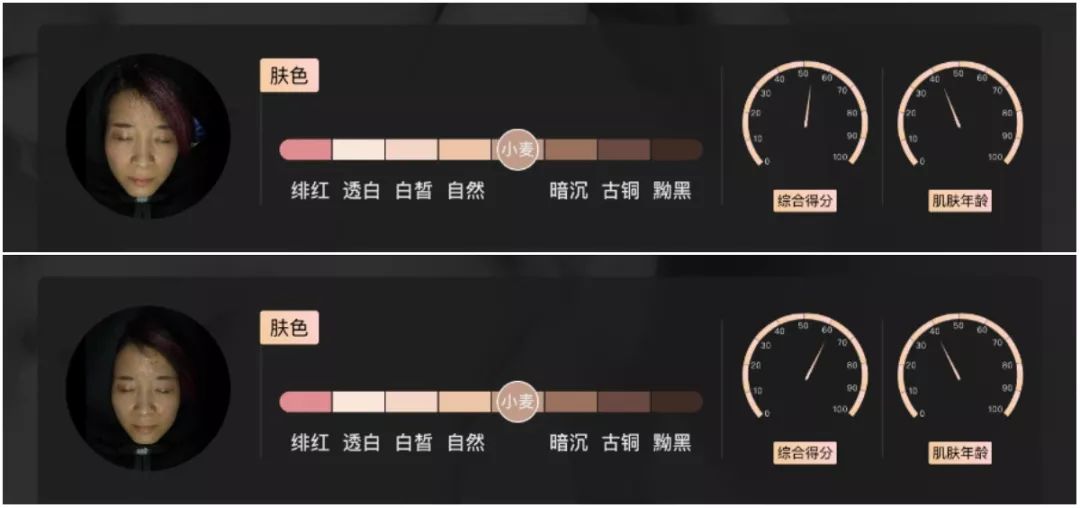 小茂肌诊室到底有多强,小茂肌诊室皮肤状态