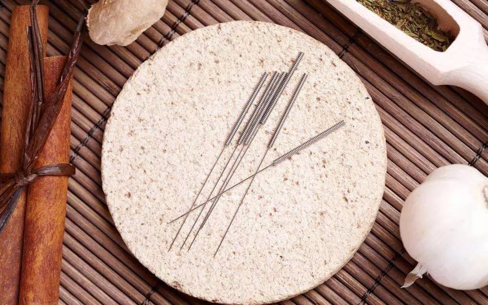 针灸可以用于麻醉,你知道吗?——写在针刺麻醉发展60余年