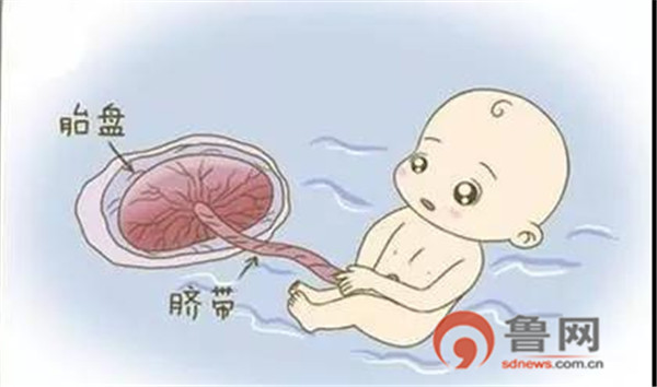 这个35+3周的宝宝出生时脐带扭成了麻花，且呈紫红色……