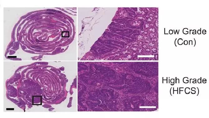 【有益思】不仅是长胖！《科学》：饮料中的糖浆，加速肿瘤生长