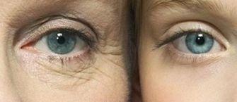 吃各种美容类保健品有用吗,吃了能美白紧致皮肤的产品