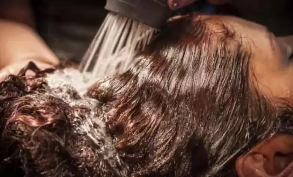 头皮屑多怎么办教你一招解决,头皮屑多怎么办教你一招