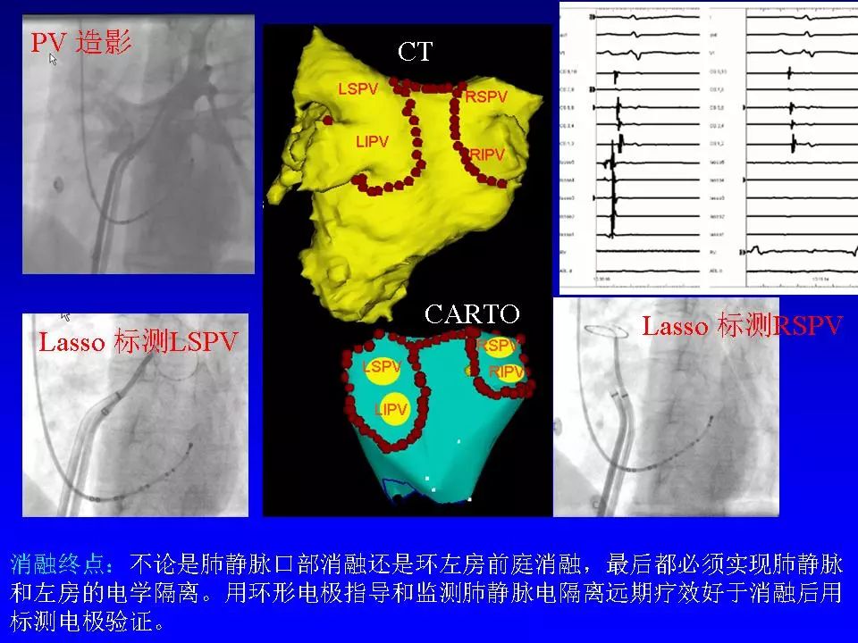 方丕华医生在哪个医院出诊,阜外方丕华出诊时间