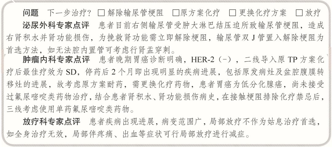 卵巢恶性肿瘤伴腹膜多发转移,原发卵巢癌伴腹膜多发转移