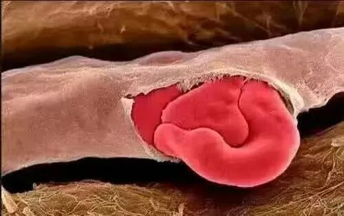 常见的美容激光项目,脉冲激光治疗后的注意事项