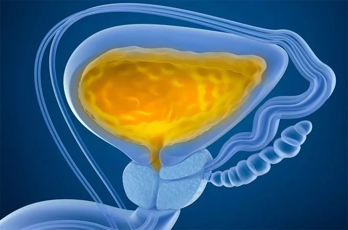 膀胱癌分期及各期治疗方案,膀胱癌叙述