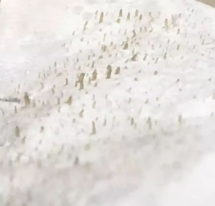 清洁毛孔|又爽又恶心的去黑头方法来了！5分钟将你10年的黑头白头连根拔起