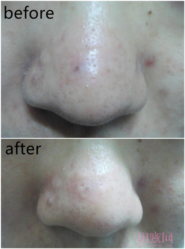 美帕补水面膜,美帕海粘土面膜