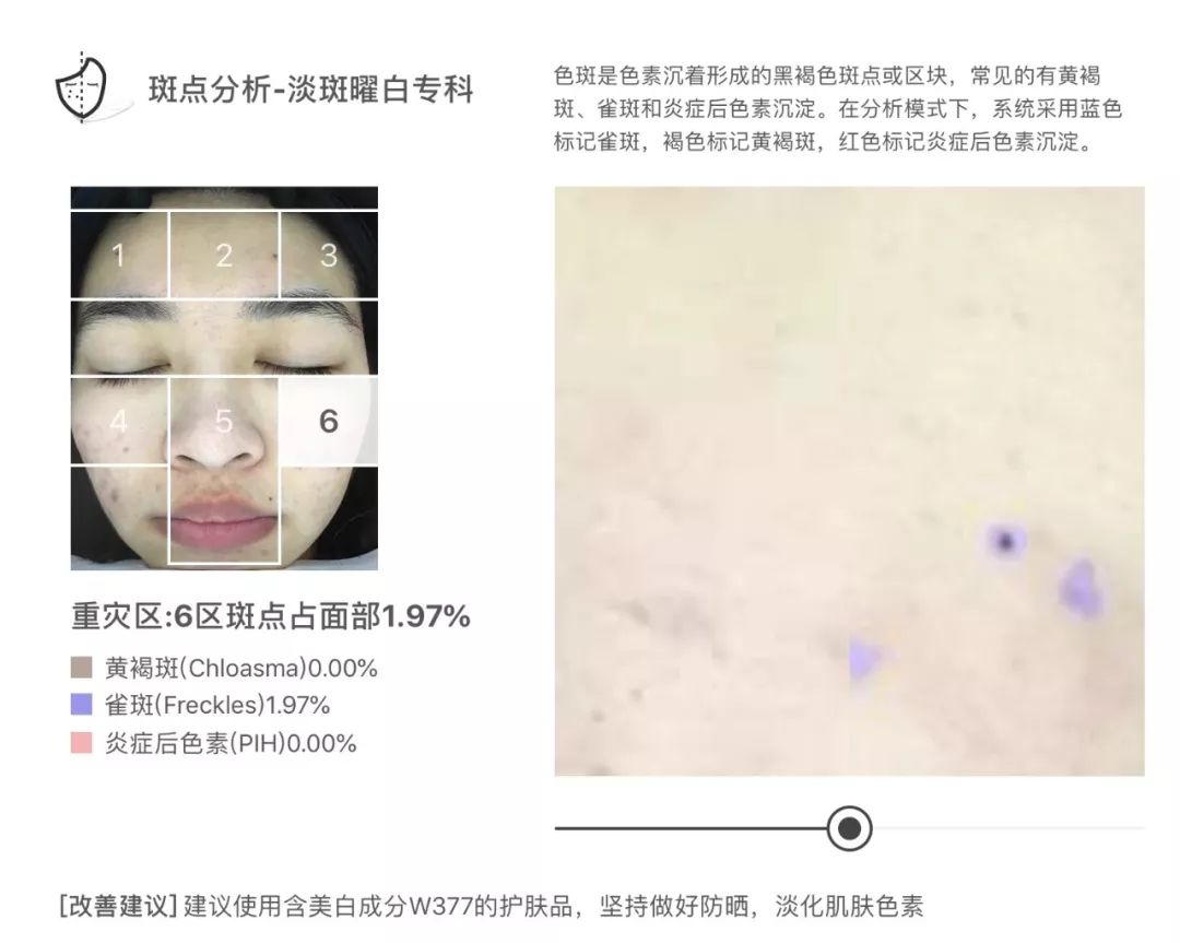 灏忚寕鑲岃瘖瀹ゅ埌搴曟湁澶氬己,灏忚寕鑲岃瘖瀹よˉ姘村悧