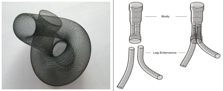 华西主动脉夹层手术怎样,再次救治急性主动脉夹层取得成功