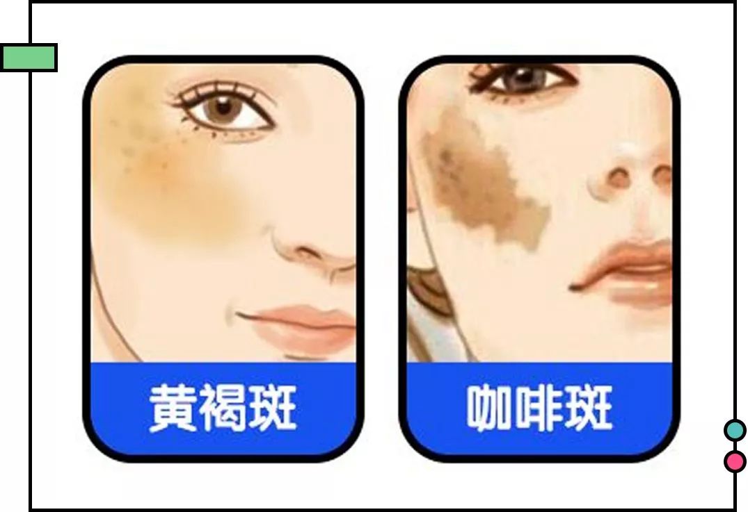 怀孕变丑真正原因,什么时候怀孕变难看