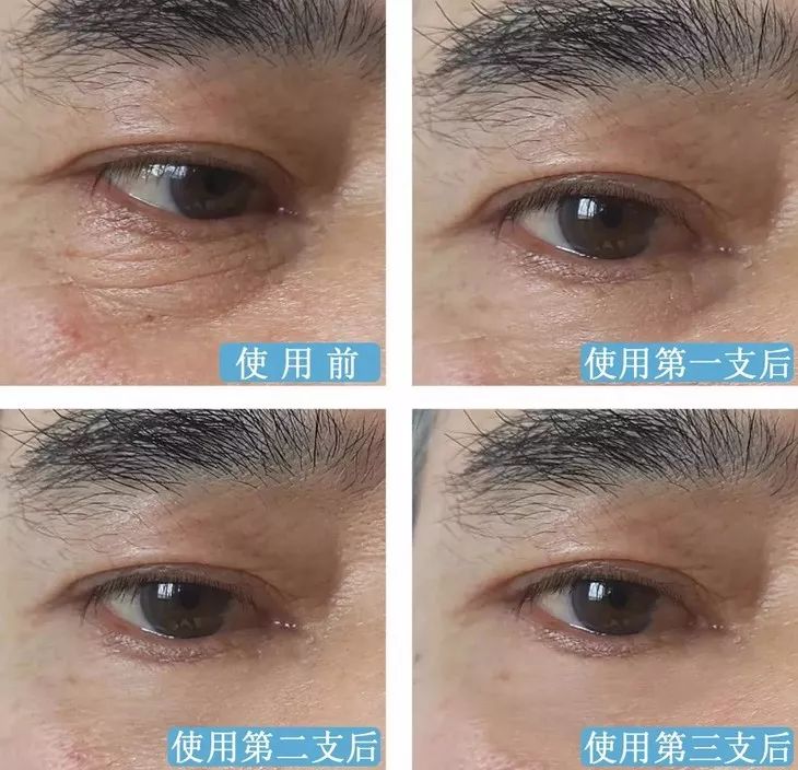 德国变态震动棒,啪啪啪间抚平眼袋、黑眼圈!不用开刀,就能让你年轻十岁!