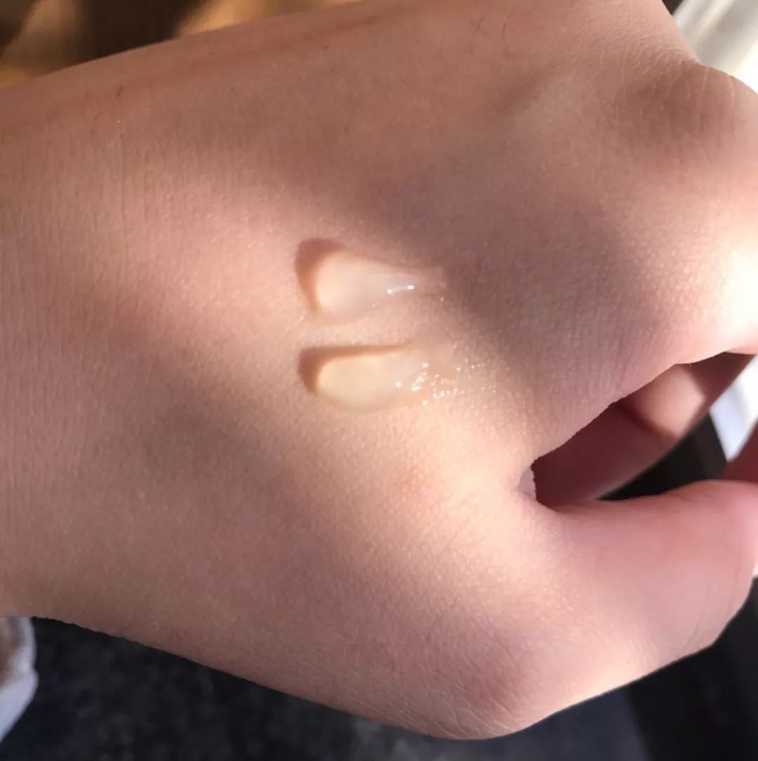 祛痘药膏指南,国内祛痘绝招排名榜最新