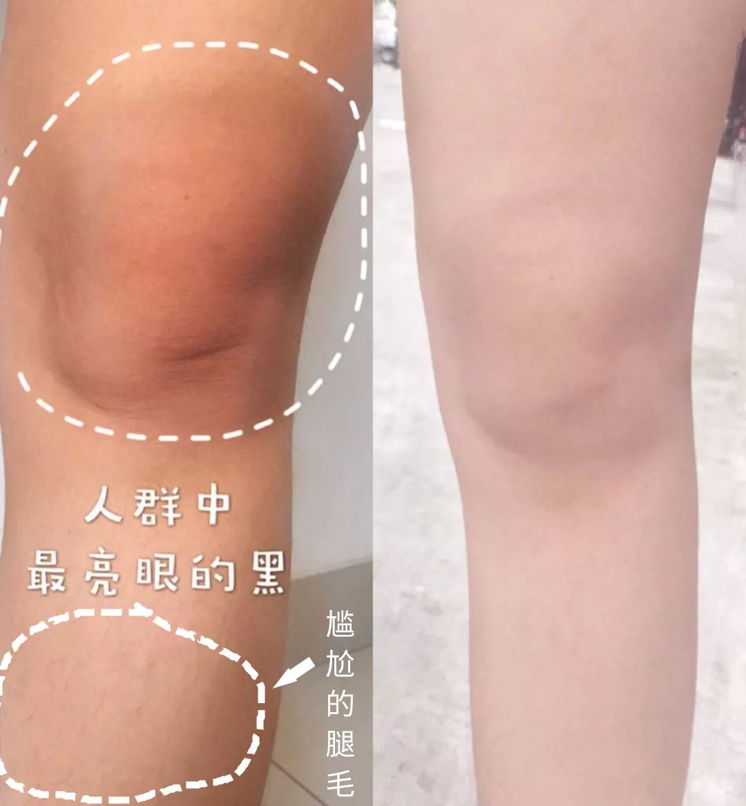 液体*袜丝**是什么鬼？用过的妹子都尖叫！黑腿瑕疵都没了