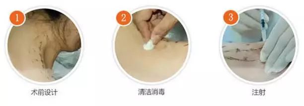 童星逆袭视频,童星有哪些成功转型