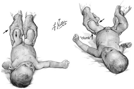 graf教授,graf法髋关节超声检查正常值