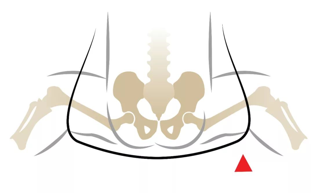 graf教授,graf法髋关节超声检查正常值