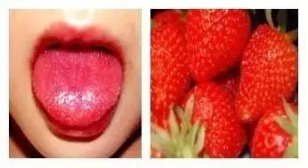 紧急提醒小孩用药,紧急提醒高发病