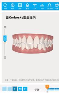 怀孕可以做乳房矫正吗,30岁哺乳期矫正牙齿的利与弊