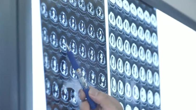 一个肾64万？34岁男子为还债卖肾连续被骗“医生”竟藏身网吧