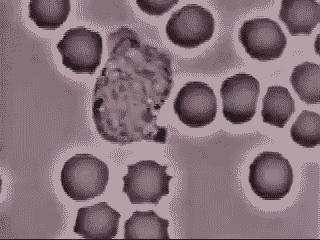 我们的城市病了怎么办,我们的城市病了英文视频