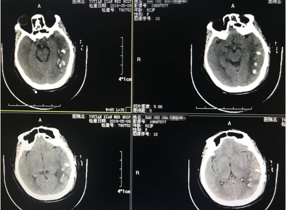 打开一扇“小窗”，还您身体健康！