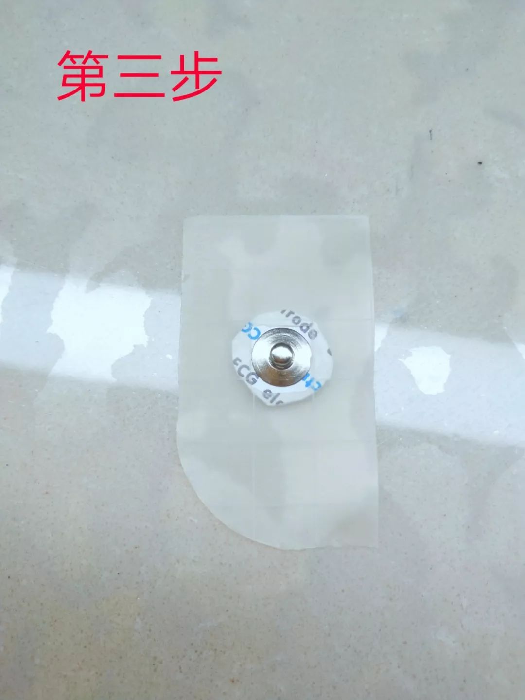 电极片皮试过敏,电极贴过敏的整改措施