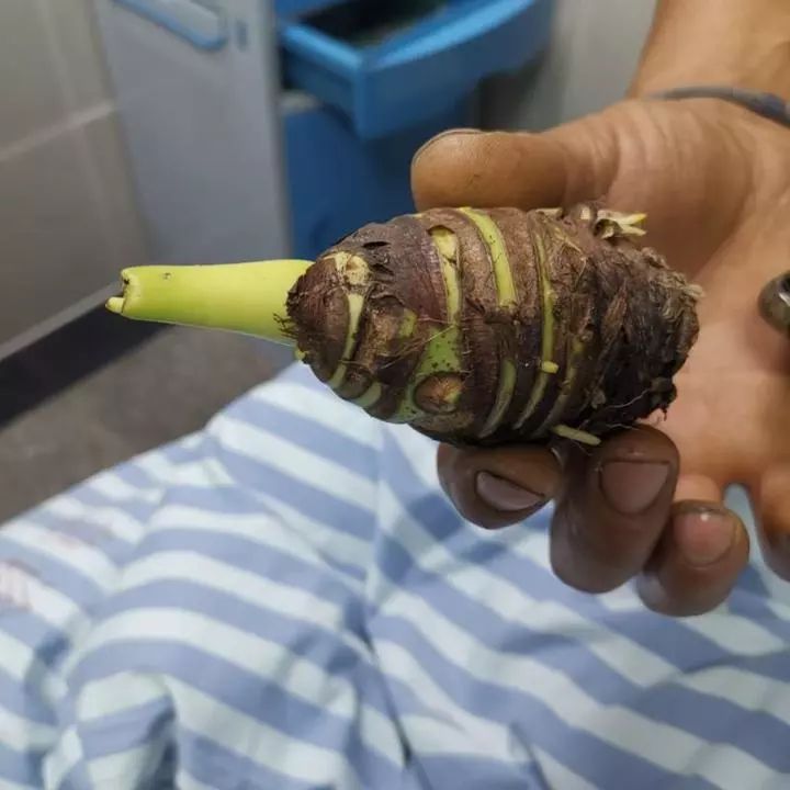 崇左人注意！碰了一下就中毒，严重者可致命！这个毒物很多人家里有！