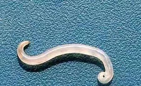 惊!长春高二女生头上洗出数条1厘米长白虫子!这个习惯你有吗?