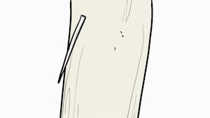 凶险！一口气喝完鱼汤后胸口刺痛！没想到竟需要8个科室10多位专家联手……