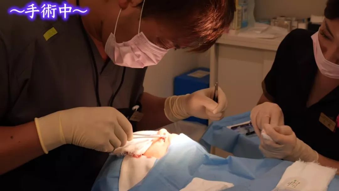 日本整形医生石原里美,石原里美脸部变美技巧