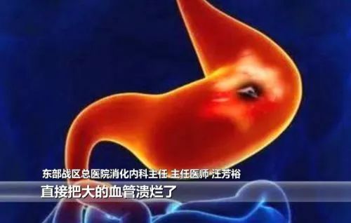 男子熬夜吐血出血点,男人熬夜10天大出血