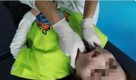 颞下颌关节紊乱病治疗的首选方法,颞下颌关节紊乱综合征怎么治愈