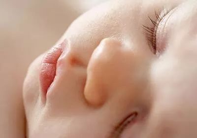 宝宝鼻梁有青筋需要怎么调理,宝宝鼻梁有青筋到底是什么情况