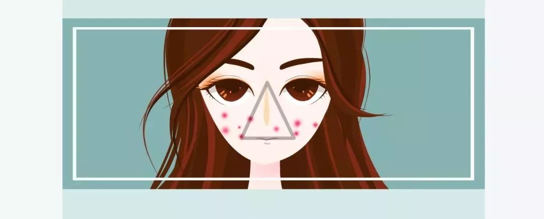 三角区的痘痘千万不要碰,三角区祛痘科普