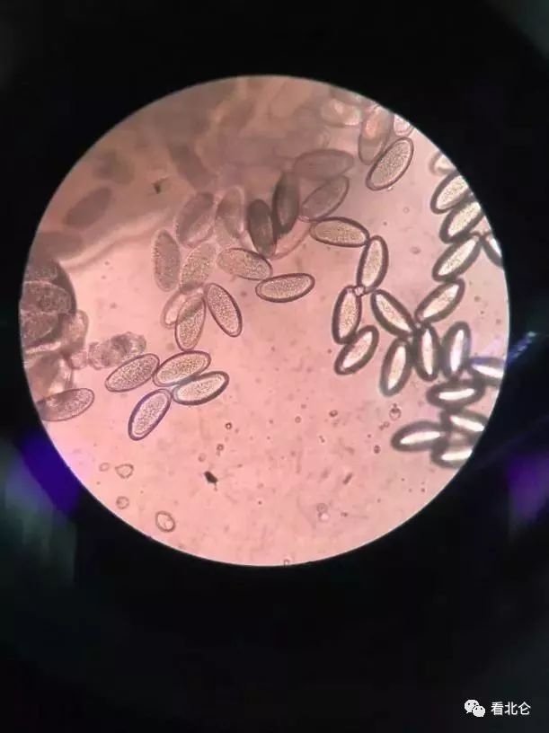 宝宝屁股痒痒怎么止痒,宝宝屁股痒怎样止痒