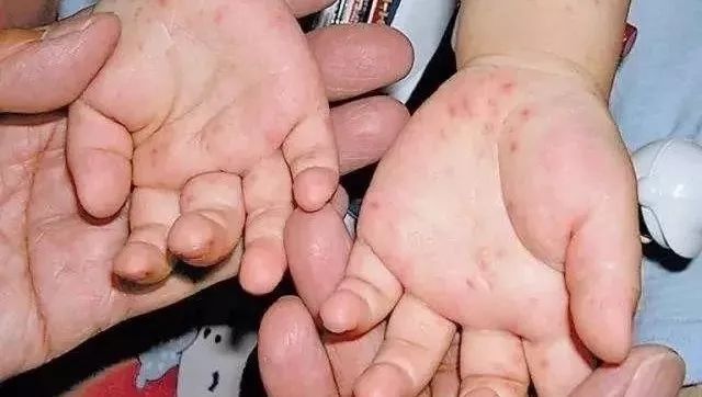 经常掉发应该看什么科,什么疾病能够引起掉发