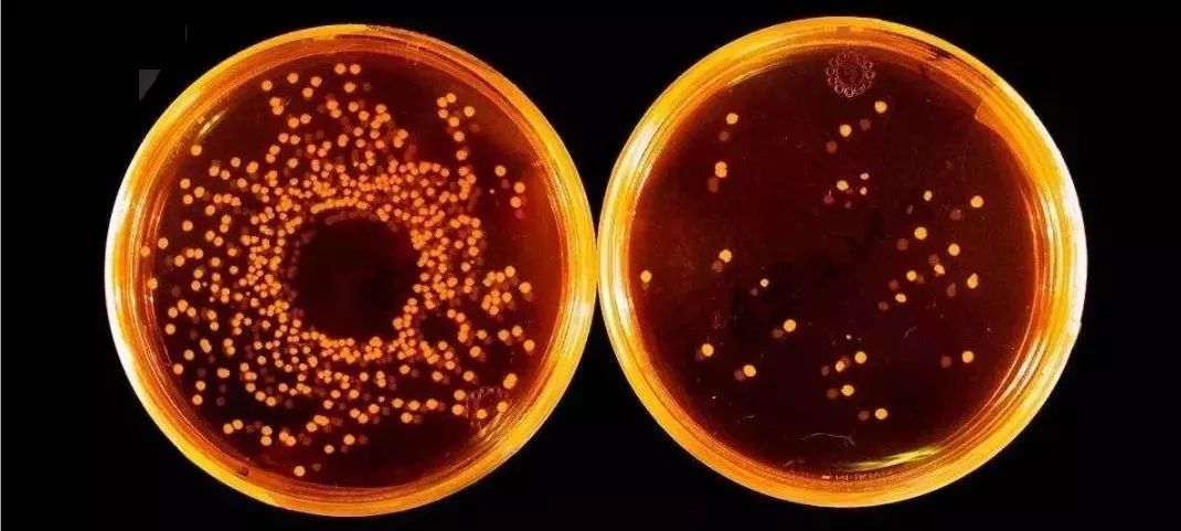 洗衣机加水有臭味怎么办,洗衣机污垢和霉菌