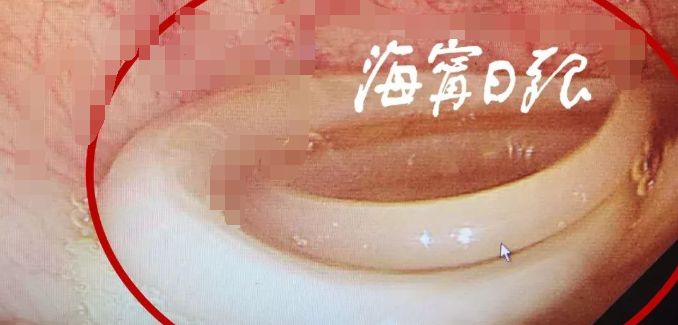 女子肚子疼去医院检查吓到医生,女孩肚子疼医生检查吓一跳电视剧