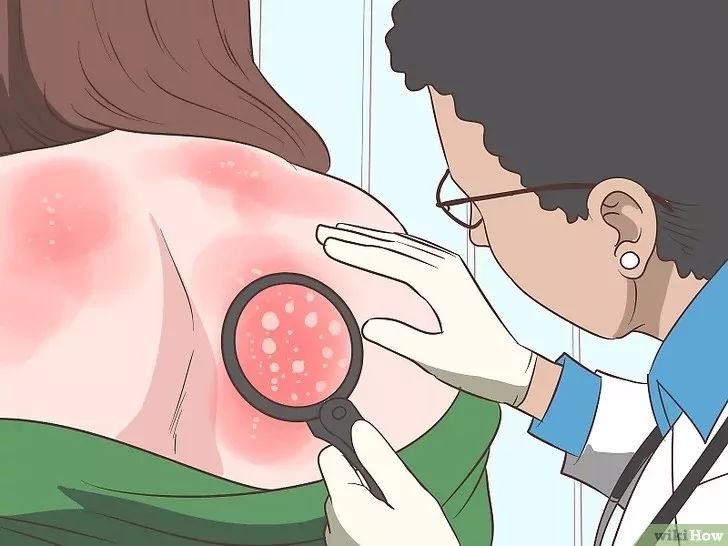 晒后急救小妙招自制面膜,晒后急救处理方法