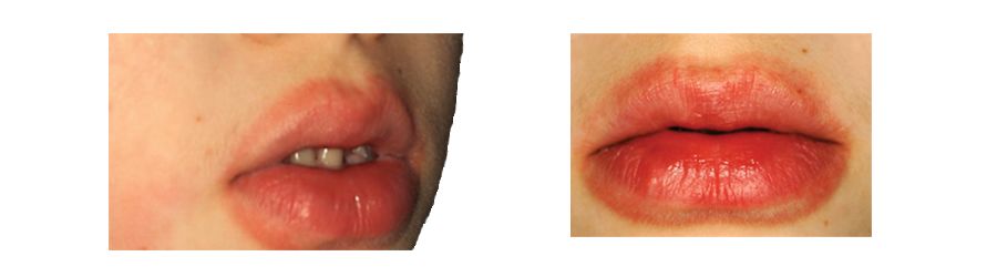 孩子睡觉吸吮怎么纠正,如何帮儿童戒掉吸吮手指