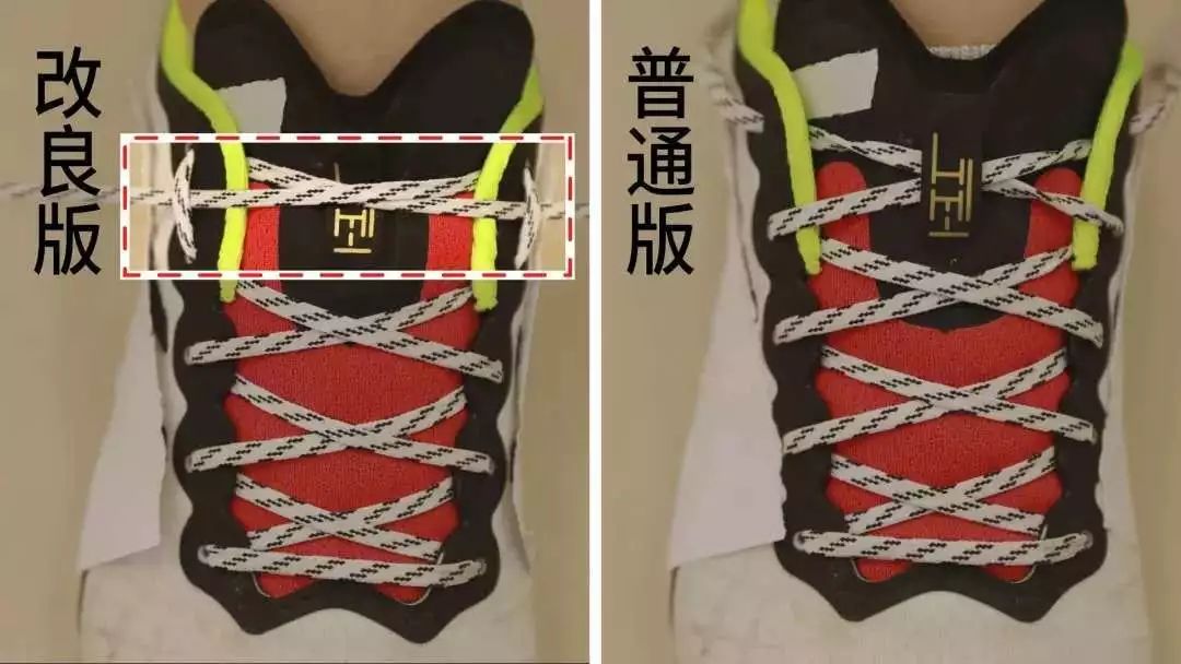 袜子掉跟小妙招怎么解决,袜子老是掉下去怎么办