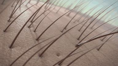 鬼剃头也没什么好治疗的方法,农村给人驱鬼办法有哪些